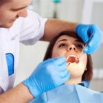 How to Choose the Best Dental Implant Specialist?