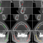 CBCT Scans and AI: A Match Made for Modern Dentistry