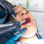 London Cosmetic Dentist Reveals the 5-Year Veneer Check-Up Essentials
