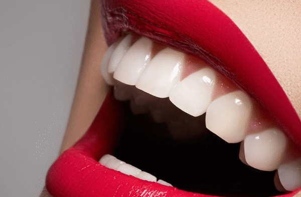 Achieve a Perfect Smile in One Visit with Composite Bonding Newcastle
